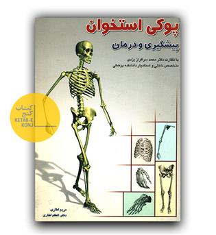 پوکی استخوان پیشگیری و درمان 